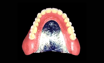 食事が楽しめる入れ歯（金属床義歯）