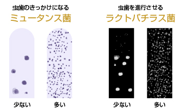 カリエスリスクテスト